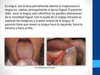 8.Lengua: con la boca parcialmente abierta se inspecciona la
lengua en reposo, principalmente el dorso lingual. El paciente
debe sacar la lengua, para identificar las posibles alteraciones
de la movilidad lingual. Con la ayuda de un espejo intraoral se
exploran los márgenes y la parte ventral de la lengua. El
paciente tiene que mover su lengua hacia la izquierda, hacia la
derecha y hacia arriba.
 