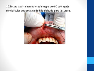 10.Sutura : porta agujas y seda negra de 4-0 con aguja
semicircular atraumatica de hilo delgado para la sutura.
 