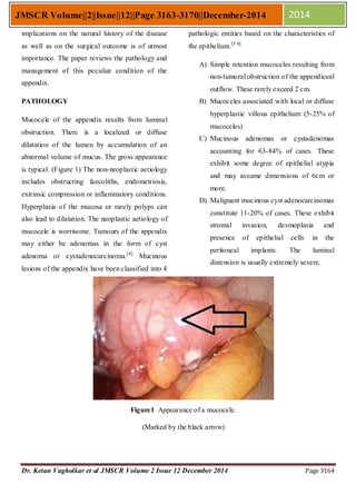 Retention Cysts Appendix Mucocele of the Appendix | PDF