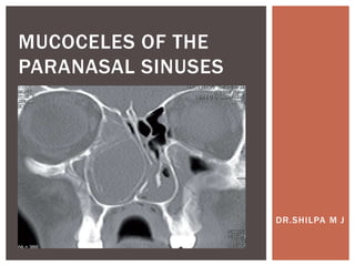 DR.SHILPA M J
MUCOCELES OF THE
PARANASAL SINUSES
 