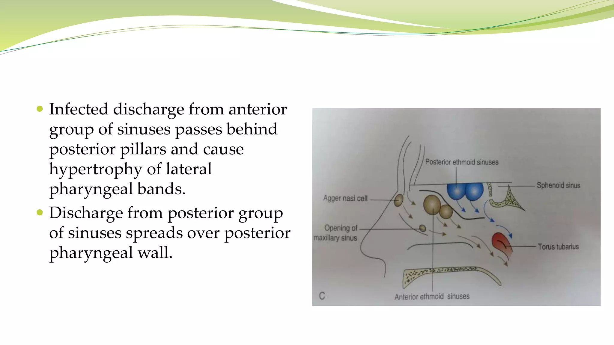  Infected discharge from anterior
group of sinuses passes behind
posterior pillars and cause
hypertrophy of lateral
pharyngeal bands.
 Discharge from posterior group
of sinuses spreads over posterior
pharyngeal wall.
 
