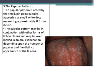 Mucocutaneous | PPTX
