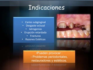 Datos claveEvaluararquitectura gingival, siestaplana o festoneadaCantidad y calidad de encíainsertadaArquitecturaósea
