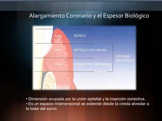 Definición…Es un proceso común e importante en la práctica quirúrgica dental que se define como:Incremento de la Longitud de la Corona ClínicaEste procedimiento involucra la remoción de tejidos periodontales duros y blandos  para obtener una mayor longitud supracrestal permitiendo una mayor longitud de la corona clínica.