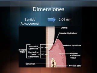 IndicacionesCaries subgingivalDesgaste oclusalIatrogeniasErupción retardadaFracturas Razones EstéticasPueden provocar :- Problemas periodontales, restauradores y estéticos.