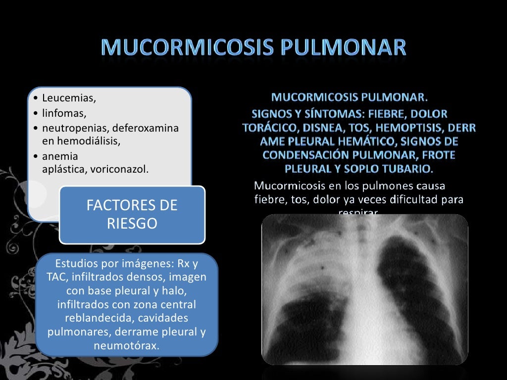 MUCORMICOSIS