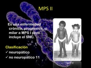 Boca entreabierta con lengua grande