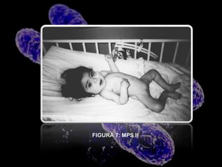 Orejas con su implantación baja.