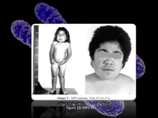 Se hereda de manera autosómica recesiva . 9MANIFESTACIONES MAS COMUNES DE MPS IOpacidad corneal