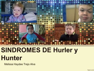 SINDROMES DE Hurler y
Hunter
Melissa Haydee Trejo Alva
 