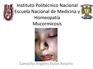 Instituto Politécnico Nacional
Escuela Nacional de Medicina y
Homeopatía
Mucormicosis
Camacho Angeles Dulce Rosario
 