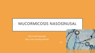 MUCORMICOSIS NASOSINUSAL
Otorrinolaringología
Mary Jose santiago Benítez
9 C
 