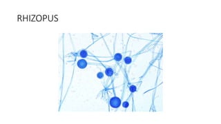 RHIZOPUS
 