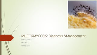 MUCORMYCOSIS: Diagnosis &Management
Dr.Aneesa Shahul.S
DM Fellow
AIIMS Jodhpur
 