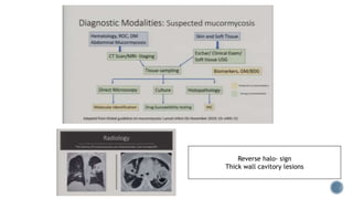Reverse halo- sign
Thick wall cavitory lesions
 