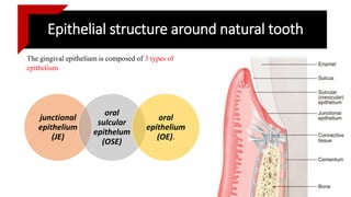 Epithelial structure around natural tooth
The gingival epithelium is composed of 3 types of
epithelium
junctional
epithelium
(JE)
oral
sulcular
epithelum
(OSE)
oral
epithelium
(OE).
 