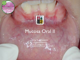 Mucosa Oral II
        Rafael Rubí Kauterich
         Cirujano Dentista
      Académico colaborador HIPA 205
(Equipo de especialistas Area de Odontología)
 
