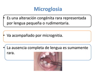 Microglosia
• Es una alteración congénita rara representada
por lengua pequeña o rudimentaria.
• Va acompañado por micrognitia.
• La ausencia completa de lengua es sumamente
rara.

 