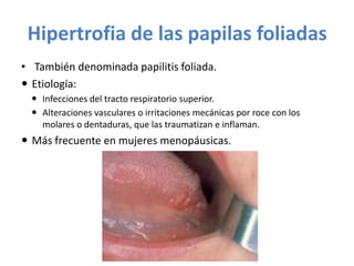Hipertrofia de las papilas foliadas
• También denominada papilitis foliada.
 Etiología:
 Infecciones del tracto respiratorio superior.
 Alteraciones vasculares o irritaciones mecánicas por roce con los
molares o dentaduras, que las traumatizan e inflaman.

 Más frecuente en mujeres menopáusicas.

 