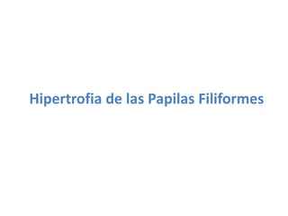 Hipertrofia de las Papilas Filiformes

 