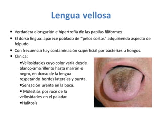 Lengua vellosa
 Verdadera elongación e hipertrofia de las papilas filiformes.
 El dorso lingual aparece poblado de “pelos cortos” adquiriendo aspecto de
felpudo.
 Con frecuencia hay contaminación superficial por bacterias u hongos.
 Clínica:
Vellosidades cuyo color varía desde
blanco-amarillento hasta marrón o
negro, en dorso de la lengua
respetando bordes laterales y punta.
Sensación urente en la boca.
 Molestias por roce de la
vellosidades en el paladar.
Halitosis.

 