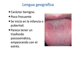 Lengua geografica
 Carácter benigno.
 Poco frecuente
 Se inicia en la infancia o
pubertad.
 Parece tener un
trasfondo
psicosomático,
empeorando con el
estrés.

 
