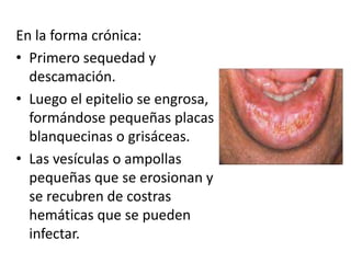 En la forma crónica:
• Primero sequedad y
descamación.
• Luego el epitelio se engrosa,
formándose pequeñas placas
blanquecinas o grisáceas.
• Las vesículas o ampollas
pequeñas que se erosionan y
se recubren de costras
hemáticas que se pueden
infectar.

 