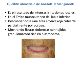 Queilitis abrasiva o de Anzilotti y Manganotti
• Es el resultado de intensas irritaciones locales.
• En el límite mucocutaneo del labio inferior.
• Descubriéndose una área erosiva roja cubierta
parcialmente por costras.
• Mostrando fisuras dolorosas con tejidos
granulomatoso rico en plasmocitos.

 