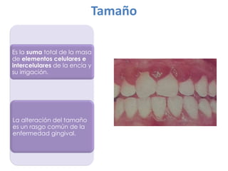 Tamaño
Es la suma total de la masa
de elementos celulares e
intercelulares de la encía y
su irrigación.

La alteración del tamaño
es un rasgo común de la
enfermedad gingival.

 