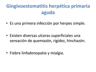 Gingivoestomatitis herpética primaria
aguda
• Es una primera infección por herpes simple.
• Existen diversas ulceras superficiales una
sensación de quemazón, rigidez, hinchazón.
• Fiebre linfadenopatia y mialgia.

 