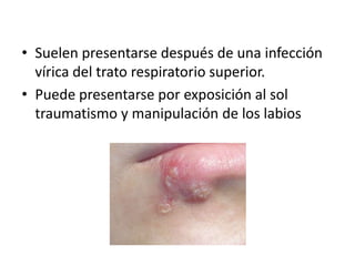 • Suelen presentarse después de una infección
vírica del trato respiratorio superior.
• Puede presentarse por exposición al sol
traumatismo y manipulación de los labios

 