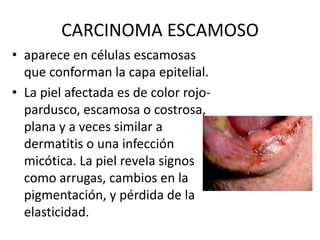 CARCINOMA ESCAMOSO
• aparece en células escamosas
que conforman la capa epitelial.
• La piel afectada es de color rojopardusco, escamosa o costrosa,
plana y a veces similar a
dermatitis o una infección
micótica. La piel revela signos
como arrugas, cambios en la
pigmentación, y pérdida de la
elasticidad.

 