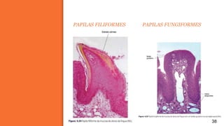 PAPILAS FILIFORMES PAPILAS FUNGIFORMES
38
 