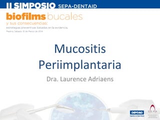 Mucositis
Periimplantaria
Dra. Laurence Adriaens

 