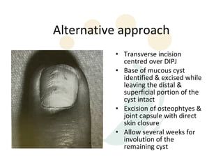Alternative approach
          • Transverse incision
            centred over DIPJ
          • Base of mucous cyst
            identified & excised while
            leaving the distal &
            superficial portion of the
            cyst intact
          • Excision of osteophtyes &
            joint capsule with direct
            skin closure
          • Allow several weeks for
            involution of the
            remaining cyst
 