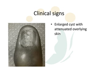Clinical signs
       • Enlarged cyst with
         attenuated overlying
         skin
 