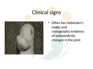 Clinical signs
       • Often has Heberden’s
         nodes and
         radiographic evidence
         of osteoarthritic
         changes in the joint
 