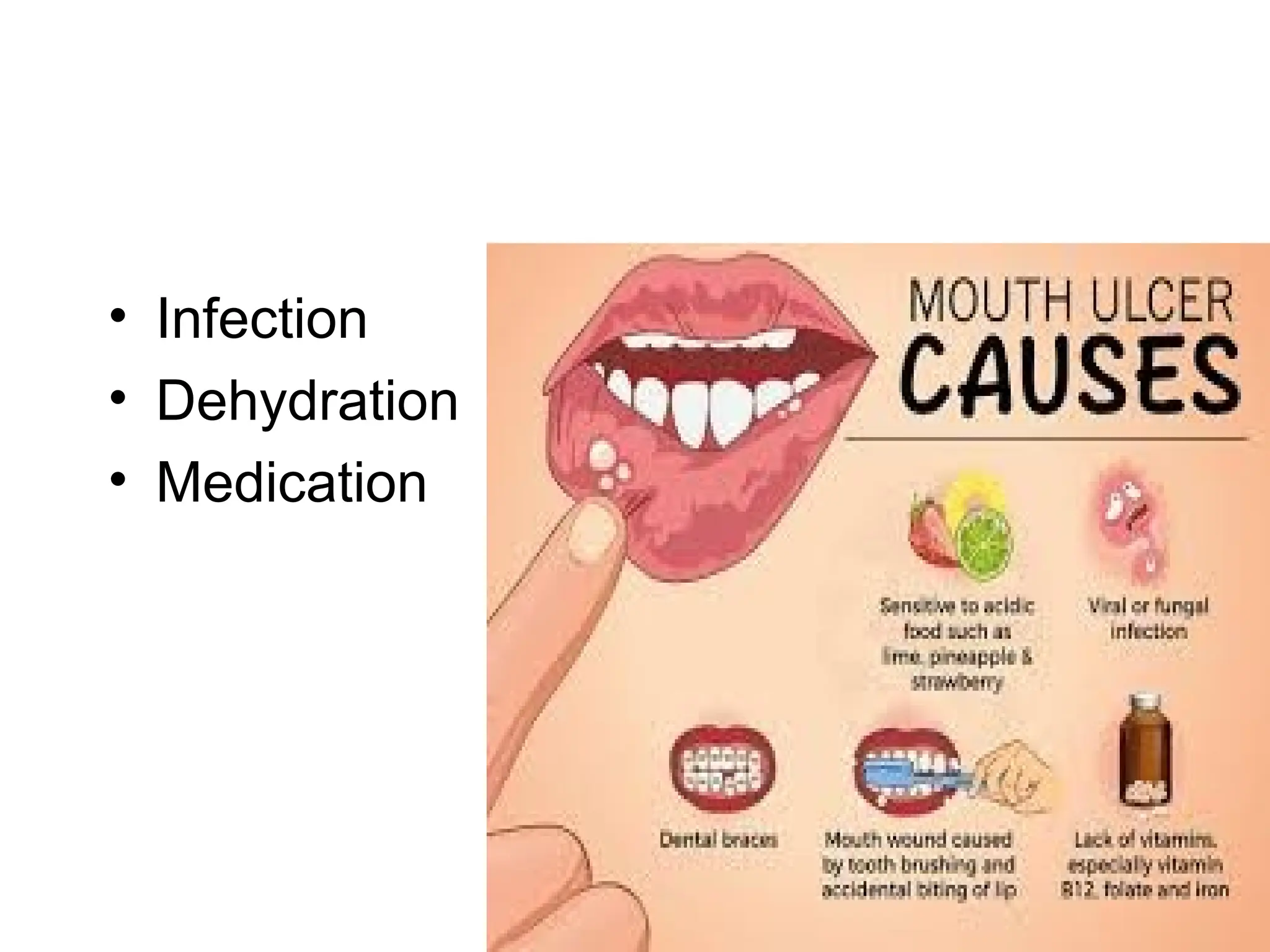 • Infection
• Dehydration
• Medication
 