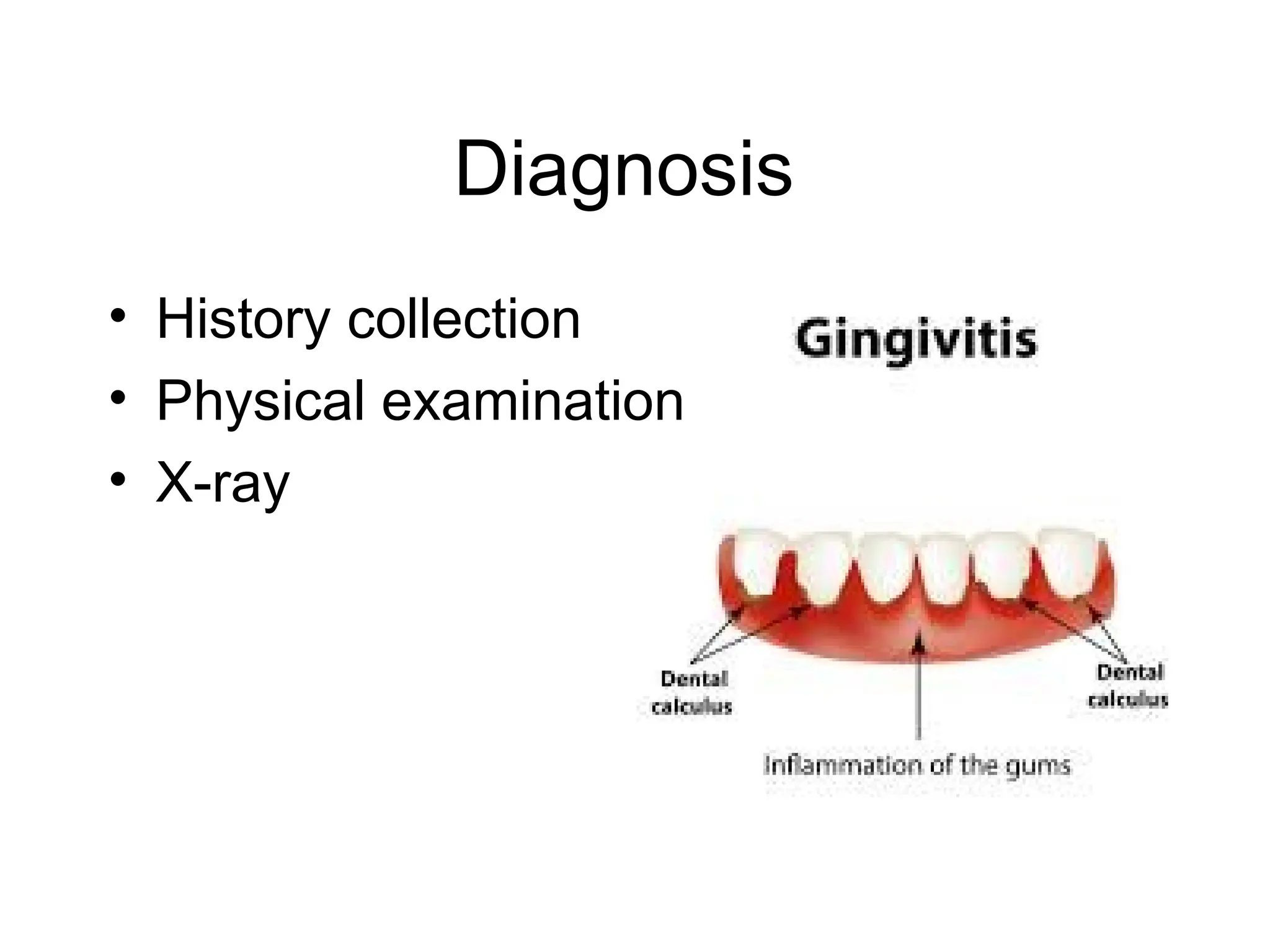 Diagnosis
• History collection
• Physical examination
• X-ray
 