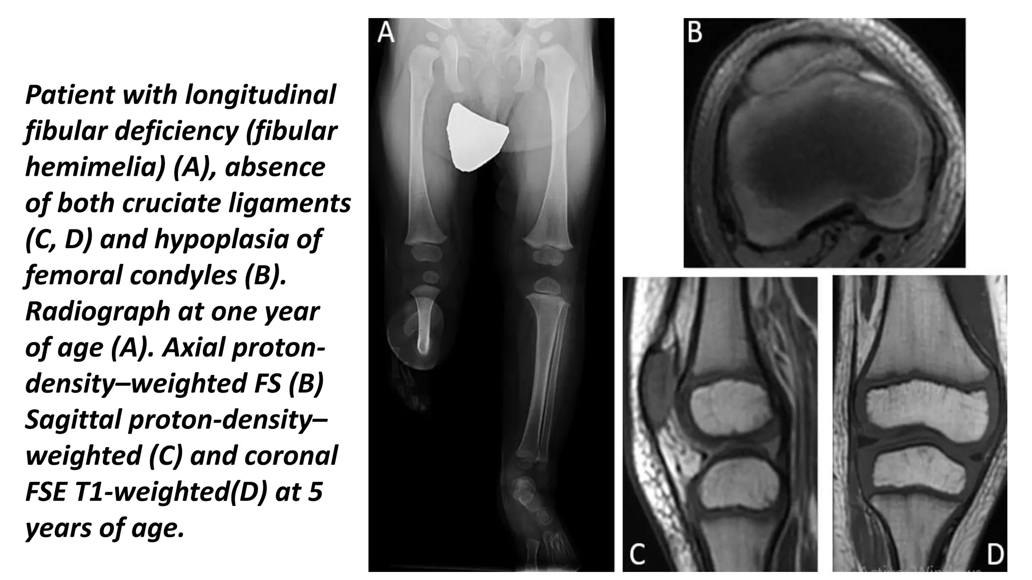 Muculoskeletal Pediatic Imaging..pptx