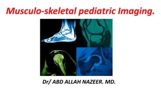 Musculo-skeletal pediatric Imaging.
Dr/ ABD ALLAH NAZEER. MD.
 
