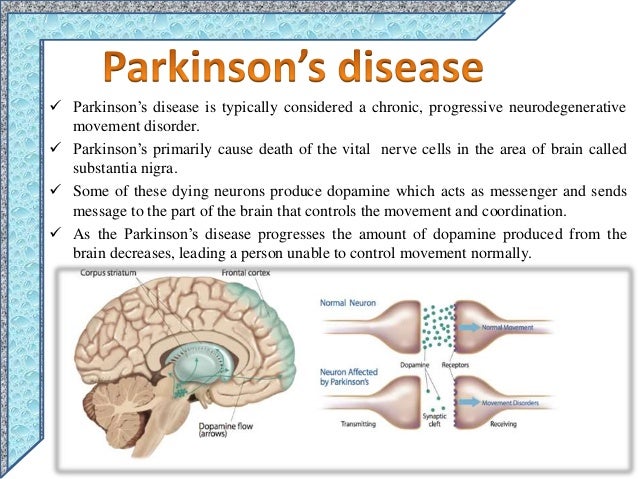 Parkinson s Disease Is A Chronic Neurodegenerative