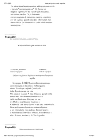07/11/2020 Mude seu cérebro, mude sua vida
https://translate.googleusercontent.com/translate_f 194/461
Ele não se dava bem com outros adolescentes na escola
e parecia "nunca se encaixar". Ele fumou um
maço de cigarros por dia e usado com frequência
maconha e cocaína. Ele já tinha sido
em um programa de tratamento e estava a caminho
por um segundo quando seus pais o trouxeram para
nossa clínica. Ele tinha tentado vários medicamentos
sem sucesso.
Página 282
262 MUDE SEU CÉREBRO, MUDE SUA VIDA
Seu estudo de SPECT cerebral mostrou um dos
casos mais graves de danos à parte esquerda
córtex frontal que eu já vi. Quando ele
tinha dezoito meses, ele caiu
Um lance de escadas. A mãe dele disse que ele tinha
nunca mais foi o mesmo desde então. Ela
sabia que havia uma diferença em sua
ity. Dado o nível de dano funcional a
Cérebro de Tim, decidi colocá-lo em uma comunicação
binação de um medicamento anticonvulsivante
e um estimulante. Isso ajudou a diminuir a raiva
e melhorar seu controle de impulso. Considerando a
nível de dano, as chances de Tim de ganhar
Cérebro afetado por trauma de Tim
3-D de cima para baixo 3-D frontal
visão de superfície visão de superfície
Observe o grande defeito no meio frontal esquerdo
região.
Página 283
Olhando para a desatenção e impulsividade 263
 