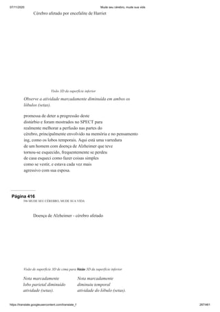 07/11/2020 Mude seu cérebro, mude sua vida
https://translate.googleusercontent.com/translate_f 287/461
promessa de deter a progressão deste
distúrbio e foram mostrados no SPECT para
realmente melhorar a perfusão nas partes do
cérebro, principalmente envolvido na memória e no pensamento
ing, como os lobos temporais. Aqui está uma varredura
de um homem com doença de Alzheimer que teve
tornou-se esquecido, frequentemente se perdeu
de casa esqueci como fazer coisas simples
como se vestir, e estava cada vez mais
agressivo com sua esposa.
Cérebro afetado por encefalite de Harriet
Visão 3D da superfície inferior
Observe a atividade marcadamente diminuída em ambos os
lóbulos (setas).
Página 416
396 MUDE SEU CÉREBRO, MUDE SUA VIDA
Doença de Alzheimer - cérebro afetado
Visão de superfície 3D de cima para baixo
Nota marcadamente
lobo parietal diminuído
atividade (setas).
Visão 3D da superfície inferior
Nota marcadamente
diminuiu temporal
atividade do lóbulo (setas).
 