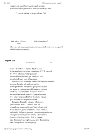07/11/2020 Mude seu cérebro, mude sua vida
https://translate.googleusercontent.com/translate_f 306/461
ou depressão significativa, embora ele cometeu
planície de curtos períodos de confusão, medo por não
O cérebro afetado pela agressão de Paul
Lado inferior 3-D ativo
Visão
Visão ativa do lado 3D
Observe a atividade acentuadamente aumentada no temporal esquerdo
lóbulo e cingulado (setas).
Página 443
O lado obscuro 423
razão e episódios de déjà vu. Seu EEG foi
dentro dos limites normais. Um estudo SPECT cerebral
foi obtido a fim de avaliar qualquer
anormalidades cerebrais que podem ter sido
contribuindo para suas dificuldades.
O estudo SPECT cerebral de Paul foi significativamente
anormal. Revelou atividade normal no
córtex pré-frontal em repouso que piorou quando
ele tentou se concentrar (problemas com impulso
sividade). Houve também moderado marcado
aumento da absorção nos aspectos profundos do
lobo temporal esquerdo (fusível curto) e o cingu-
giro tardio (preso em pensamentos).
Por causa do quadro clínico e informações
ção do estudo SPECT cerebral, Paul foi
colocado no anticonvulsivante Tegretol na terapia
níveis peuticos, junto com Prozac várias semanas
mais tarde. Após seis semanas, ele relatou que notou um
sensação de maior controle interno e paz interior.
Seus períodos de confusão, déjà vu e medo
ness diminuiu. Suas explosões de raiva diminuíram,
e ele conseguiu um novo emprego.
 