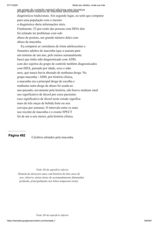 07/11/2020 Mude seu cérebro, mude sua vida
https://translate.googleusercontent.com/translate_f 340/461
um grupo de controle normal adiciona uma incerteza
porque tantos usuários de maconha adicionaram
diagnósticos tradicionais. Em segundo lugar, eu senti que comparar
para uma população com o mesmo
o diagnóstico daria informações úteis.
Finalmente, 52 por cento das pessoas com DDA têm
foi relatado ter problemas com sub-
abuso de postura, um grande número deles com
abuso de maconha.
Eu comparei as varreduras de trinta adolescentes e
fumantes adultos de maconha (que a usaram para
um mínimo de um ano, pelo menos semanalmente
base) que tinha sido diagnosticado com ADD,
com dez sujeitos do grupo de controle também diagnosticados
com DDA, pareado por idade, sexo e mão
ness, que nunca havia abusado de nenhuma droga. No
grupo maconha / ADD, por história clínica,
a maconha era a principal droga de escolha e
nenhuma outra droga de abuso foi usada no
ano passado; novamente pela história, não houve nenhum sinal
uso significativo de álcool por esses pacientes
(uso significativo de álcool neste estudo significa
mais de três onças de bebida forte ou seis
cervejas por semana). O intervalo entre os mais
uso recente de maconha e o exame SPECT
foi de um a seis meses, pela história clínica.
Página 492
Cérebros afetados pela maconha
Visão 3D da superfície inferior
Homem de dezesseis anos com história de dois anos de
uso; observe várias áreas de acentuadamente diminuídas
perfusão, principalmente nos lobos temporais (seta).
Visão 3D da superfície inferior
 