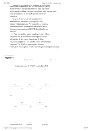 07/11/2020 Mude seu cérebro, mude sua vida
https://translate.googleusercontent.com/translate_f 37/461
Os médicos geralmente são alertados de que alguns
coisa está errada em uma das três maneiras: eles veem
muita atividade em uma determinada área; eles vêem
muito pouca atividade em uma determinada área; ou eles veem
áreas assimétricas de atividade que deveriam ser
simétrico.
No resto do livro, vou entrar em maiores
detalhes sobre como essa tecnologia notável
tocou a vida das pessoas. Por enquanto, no entanto,
Vou simplesmente oferecer uma amostra de cinco
formas em que os estudos SPECT são utilizados em
remédio.
1. Para possibilitar a intervenção precoce . Ellen,
sessenta e três, ficou repentinamente paralisado no
lado direito de seu corpo. Incapaz até de falar,
ela estava em pânico e sua família estava extremamente
em causa. Tão drásticos quanto esses sintomas
foram, duas horas após o evento, sua tomografia computadorizada
Página 57
Imagens na mente 37
Estudos normais de SPECT cerebral em 3-D
costas topo frente
frente inferior costas
visão de superfície de cima para baixo vista frontal de superfície viewtop da superfície inferior
topo topo
frente
inferior inferior
vista de superfície lateral visão lateral ativa
costas topo frente
frente inferior costas
visualização ativa de cima para baixo vista ativa frontal visão ativa inferior
 