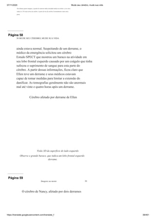 07/11/2020 Mude seu cérebro, mude sua vida
https://translate.googleusercontent.com/translate_f 38/461
Nas últimas quatro imagens, a grade de contorno indica atividade média no cérebro; a cor clara
indica os 15% mais ativos do cérebro. A parte de trás do cérebro é normalmente a mais ativa
parte.
Página 58
38 MUDE SEU CÉREBRO, MUDE SUA VIDA
ainda estava normal. Suspeitando de um derrame, o
médico da emergência solicitou um cérebro
Estudo SPECT que mostrou um buraco na atividade em
seu lobo frontal esquerdo causado por um coágulo que tinha
sufocou o suprimento de sangue para esta parte do
cérebro. A partir dessas informações, ficou claro que
Ellen teve um derrame e seus médicos estavam
capaz de tomar medidas para limitar a extensão do
danificar. As tomografias geralmente não são anormais
mal até vinte e quatro horas após um derrame.
Cérebro afetado por derrame de Ellen
Visão 3D da superfície do lado esquerdo
Observe o grande buraco, que indica um lobo frontal esquerdo
derrame.
Página 59
Imagens na mente 39
O cérebro de Nancy, afetado por dois derrames
 