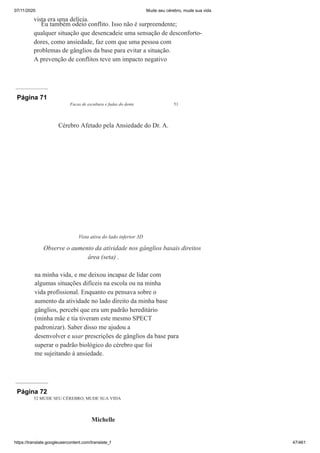 07/11/2020 Mude seu cérebro, mude sua vida
https://translate.googleusercontent.com/translate_f 47/461
vista era uma delícia.
Eu também odeio conflito. Isso não é surpreendente;
qualquer situação que desencadeie uma sensação de desconforto-
dores, como ansiedade, faz com que uma pessoa com
problemas de gânglios da base para evitar a situação.
A prevenção de conflitos teve um impacto negativo
Página 71
Facas de escultura e fadas do dente 51
na minha vida, e me deixou incapaz de lidar com
algumas situações difíceis na escola ou na minha
vida profissional. Enquanto eu pensava sobre o
aumento da atividade no lado direito da minha base
gânglios, percebi que era um padrão hereditário
(minha mãe e tia tiveram este mesmo SPECT
padronizar). Saber disso me ajudou a
desenvolver e usar prescrições de gânglios da base para
superar o padrão biológico do cérebro que foi
me sujeitando à ansiedade.
Cérebro Afetado pela Ansiedade do Dr. A.
Vista ativa do lado inferior 3D
Observe o aumento da atividade nos gânglios basais direitos
área (seta) .
Página 72
52 MUDE SEU CÉREBRO, MUDE SUA VIDA
Michelle
À
 
