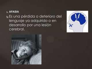    AFASIA
   Es una pérdida o deterioro del
    lenguaje ya adquirido o en
    desarrollo por una lesión
    cerebral.
 